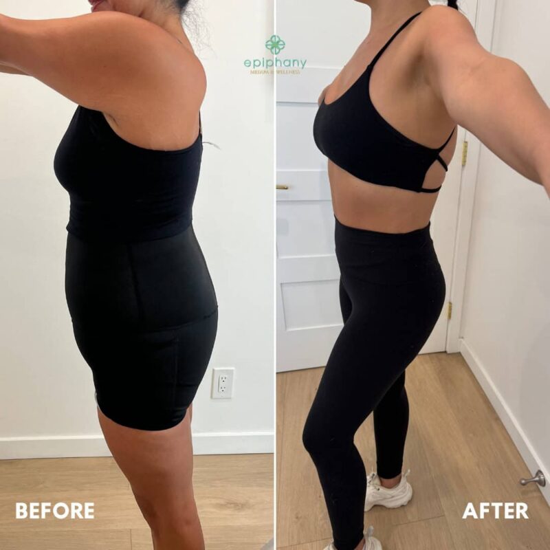 weight loss Semaglutide