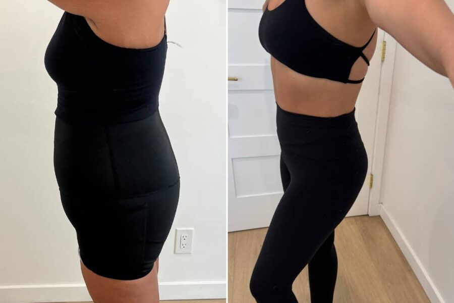 weight loss Semaglutide